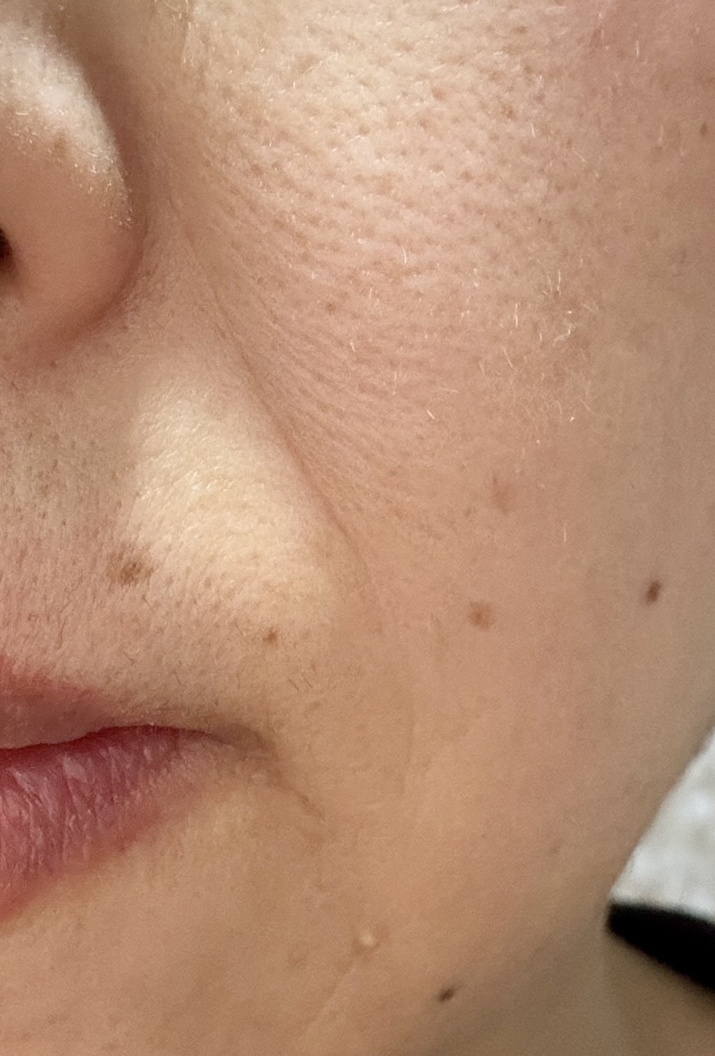 アラカンの素の肌