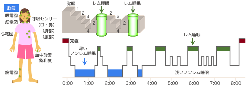 睡眠リズム