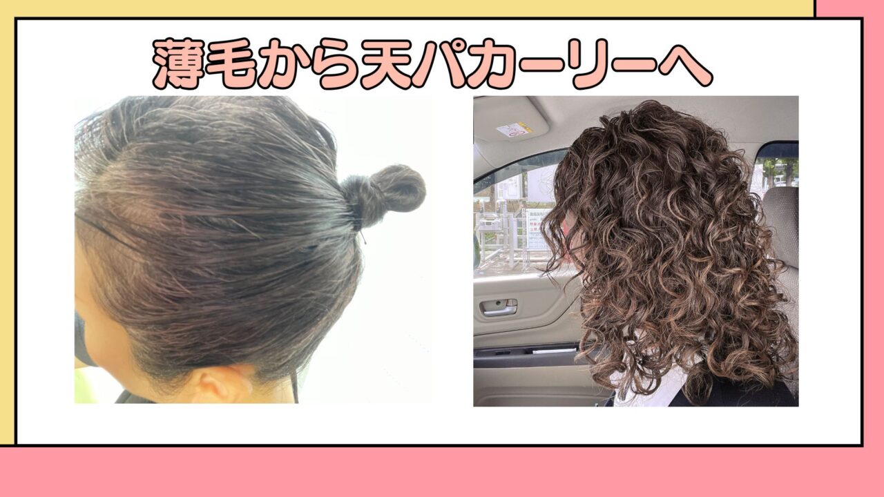 薄毛から天パカーリーへ